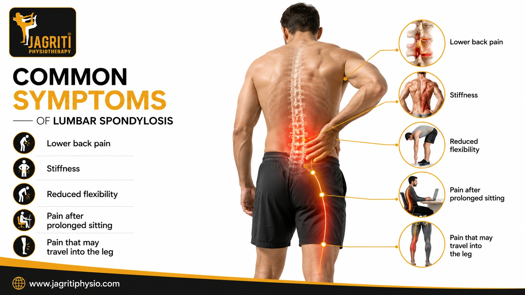 Common Symptoms of Lumbar Spondylosis