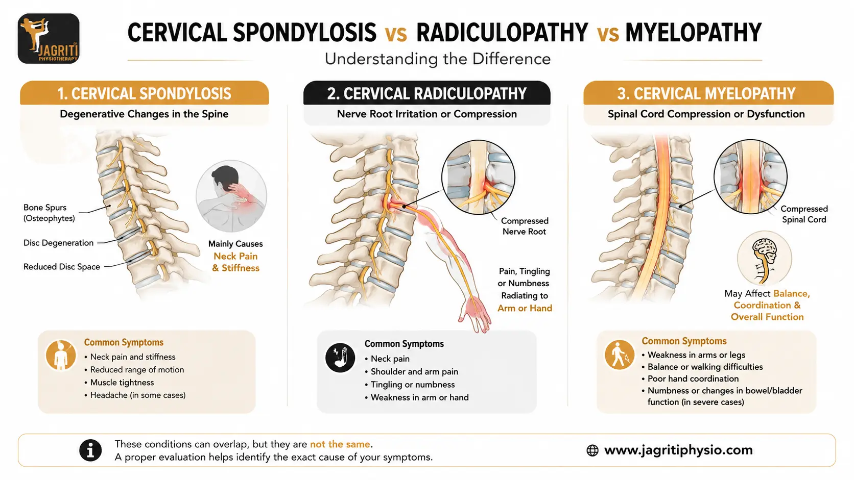 Spondylosis vs Radiculopathy vs Myelopathy